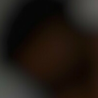 абцвотер-фри Голи