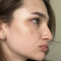 Анохина Лиза Голи