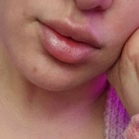 Бликси Голи