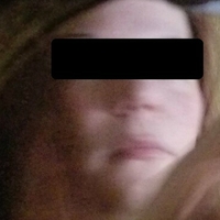 Крисбанекс Голи