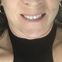 ФлаФън Голи