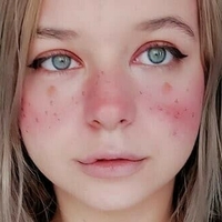 Хурона Ролера Голи