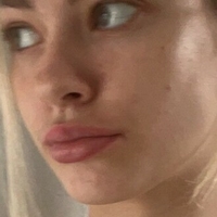 лолайслъки Голи