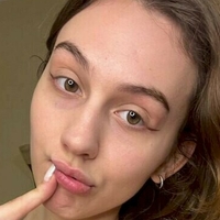 Неостикс Голи
