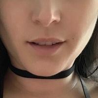 Нисевайдхофер Голи