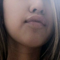 Никтонглерт Голи